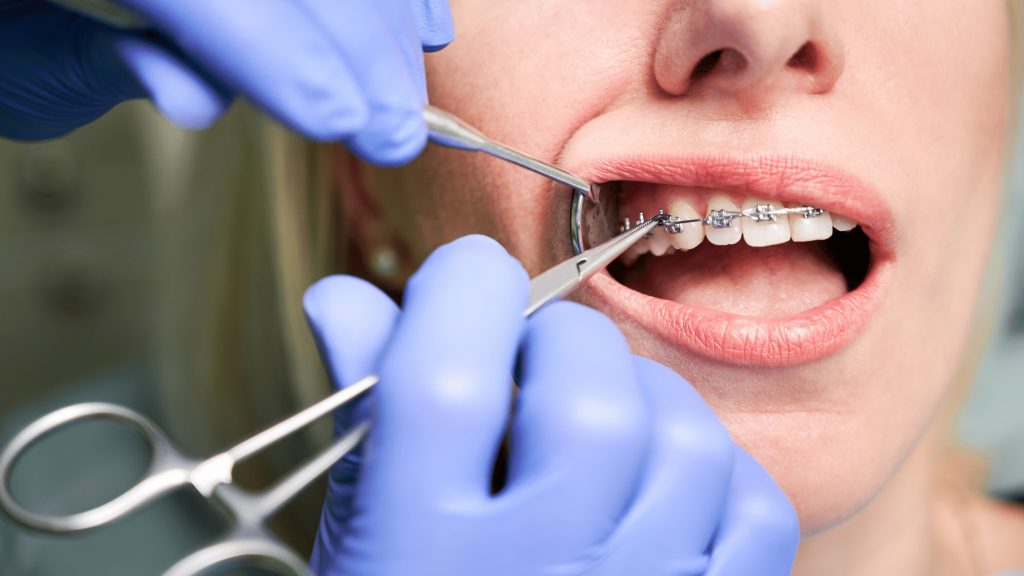 Jak zabrać się za leczenie u ortodonty
