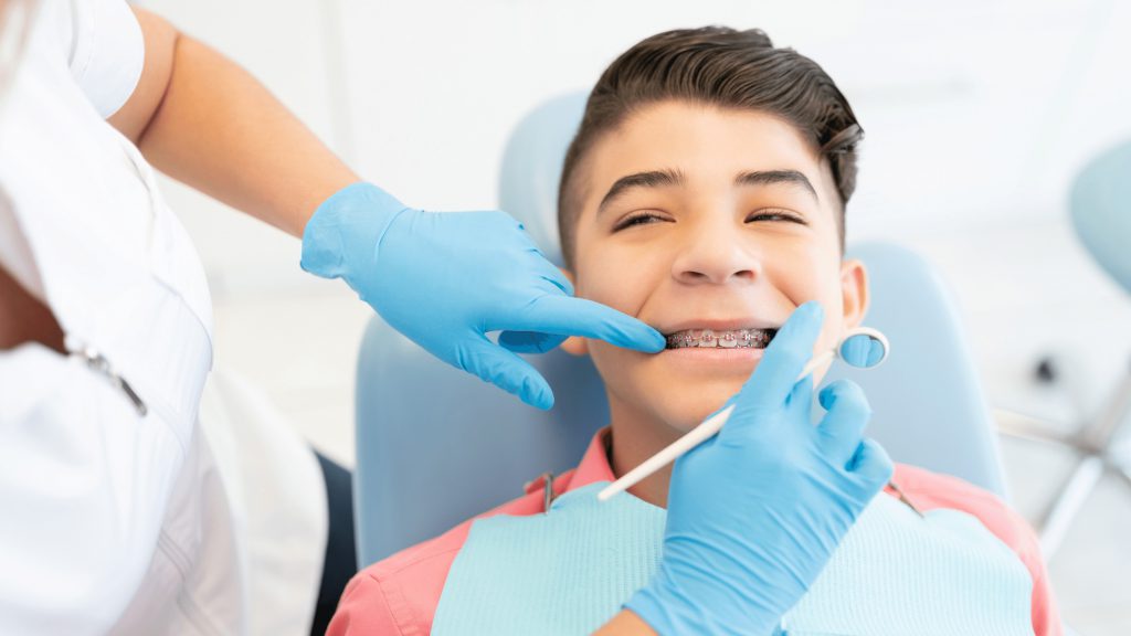 Zakładanie aparatu ortodontycznego – przebieg