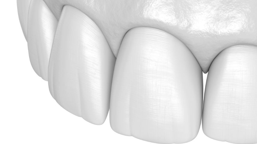 Graficzny model zębów ze zbliżeniem na siekacze